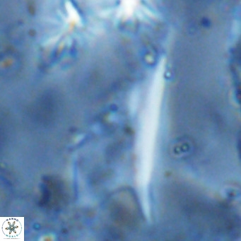 Ceratolithus dontia VR 07156
