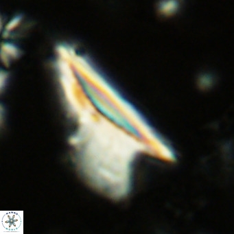 Ceratolithus dontia VR 07150