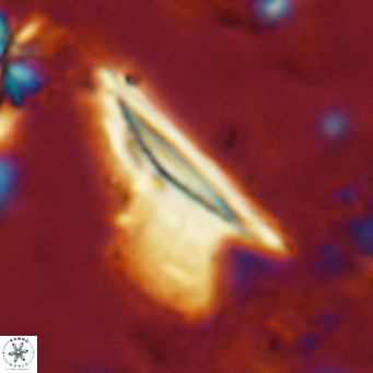 Ceratolithus dontia VR 07151