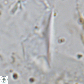 Ceratolithus dontia VR 07152