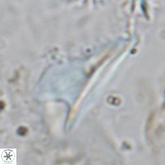 Ceratolithus dontia VR 07153