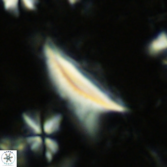 Ceratolithus dontia VR 07167