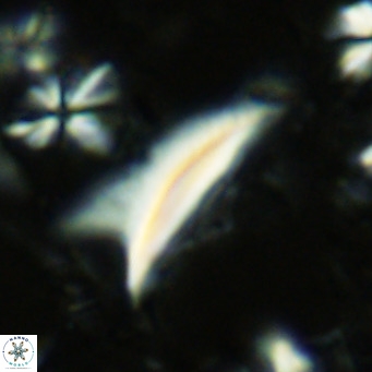 Ceratolithus dontia VR 07160