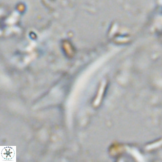 Ceratolithus dontia VR 07175