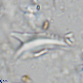 Ceratolithus dontia VR 07176