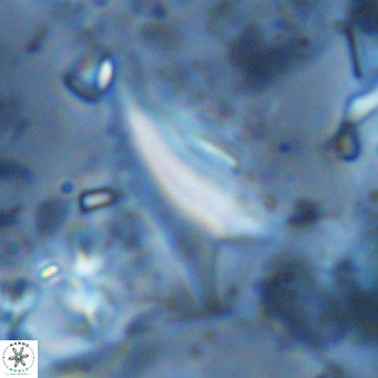 Ceratolithus dontia VR 07180