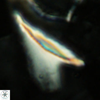 Ceratolithus dontia VR 07204