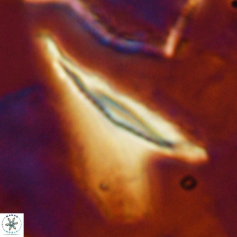 Ceratolithus dontia VR 07203