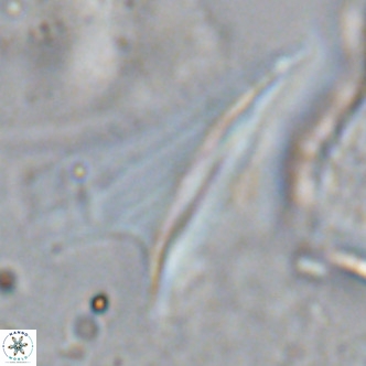 Ceratolithus dontia VR 07215