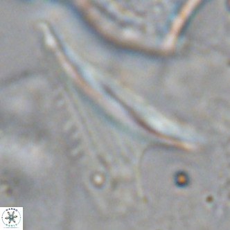 Ceratolithus dontia VR 07218