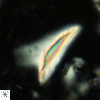 Ceratolithus dontia VR 07364