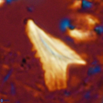 Ceratolithus dontia VR 07367