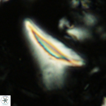 Ceratolithus dontia VR 07369