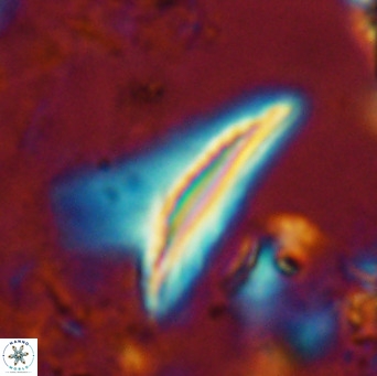 Ceratolithus dontia VR 07363