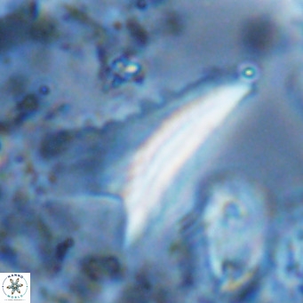 Ceratolithus dontia VR 07375