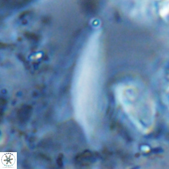 Ceratolithus dontia VR 07377