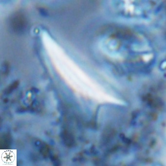 Ceratolithus dontia VR 07379