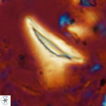 Ceratolithus dontia VR 07370