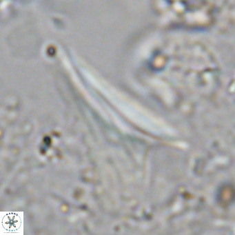 Ceratolithus dontia VR 07371