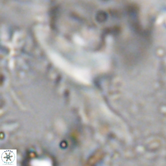Ceratolithus dontia VR 08157