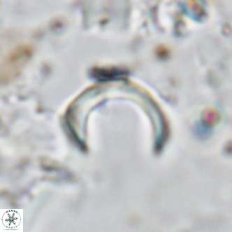 Ceratolithus imiselinos VR 08089