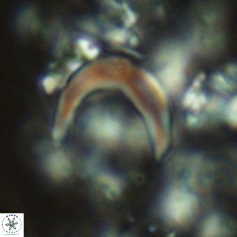 Ceratolithus simplex VR 04447
