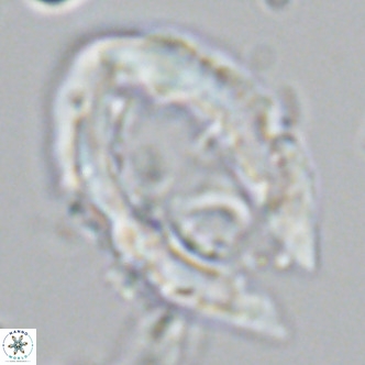 Ceratolithus rugosus VR 03478