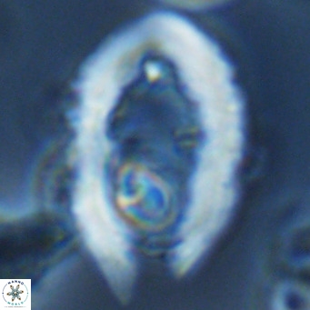 Ceratolithus rugosus VR 03481