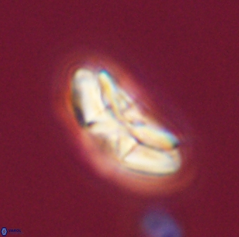 Chontriemfanisi apomnemoneumus 55791