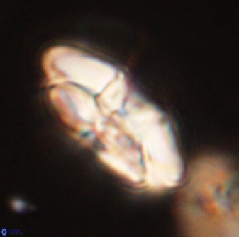 Chontriemfanisi apomnemoneumus 56456