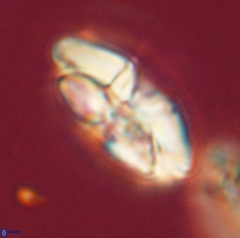 Chontriemfanisi apomnemoneumus 56457