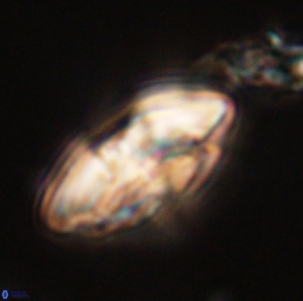 Chontriemfanisi apomnemoneumus 56461
