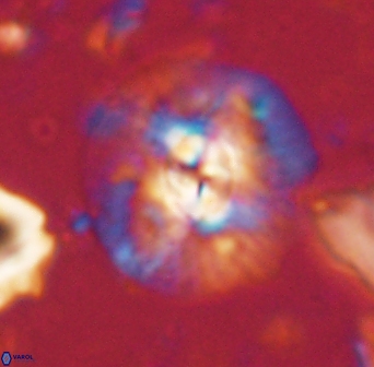 Chontriemfanisi apomnemoneumus 61371