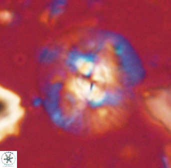 Chontriemfanisi apomnemoneumus 61371
