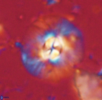 Chontriemfanisi apomnemoneumus 61372