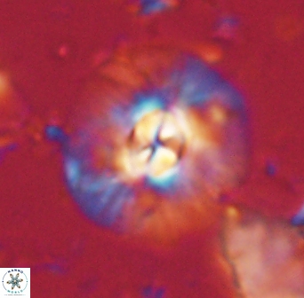 Chontriemfanisi apomnemoneumus 61372