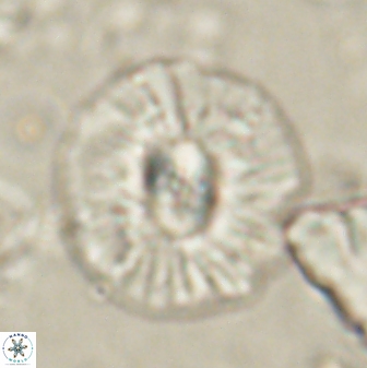 Chontriemfanisi apomnemoneumus 61376