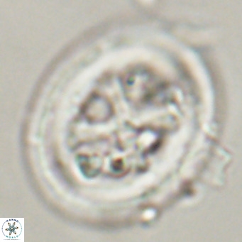 Chiasmolithus modestus VR 30735