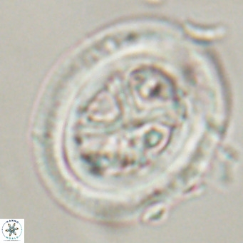 Chiasmolithus modestus VR 30736