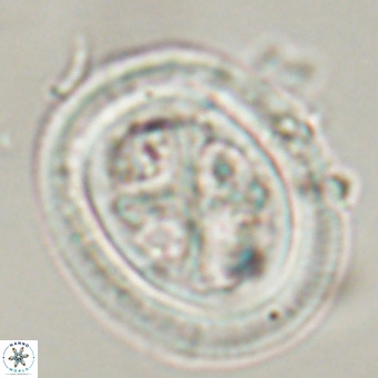 Chiasmolithus modestus VR 30738
