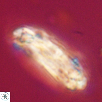 Chiasmolithus modestus VR 30753