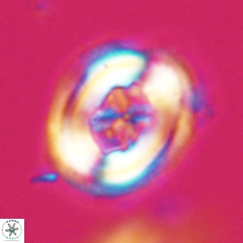 Chiasmolithus altus VR 34125