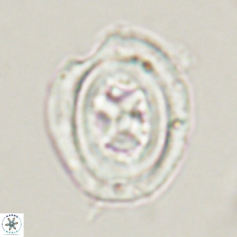 Chiasmolithus altus VR 34134