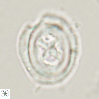 Chiasmolithus altus VR 34135