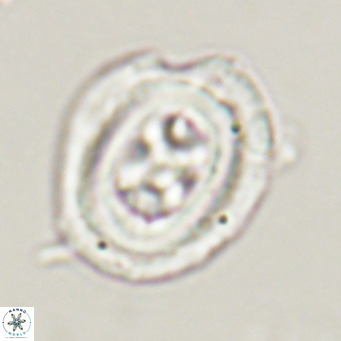 Chiasmolithus altus VR 34136