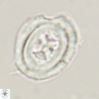 Chiasmolithus altus VR 34137