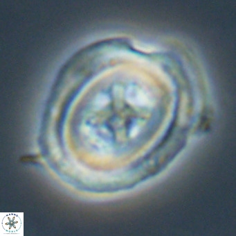 Chiasmolithus altus VR 34138