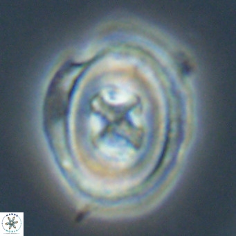 Chiasmolithus altus VR 34139