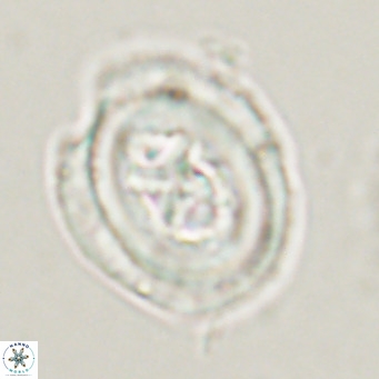 Chiasmolithus altus VR 34131