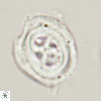 Chiasmolithus altus VR 34132